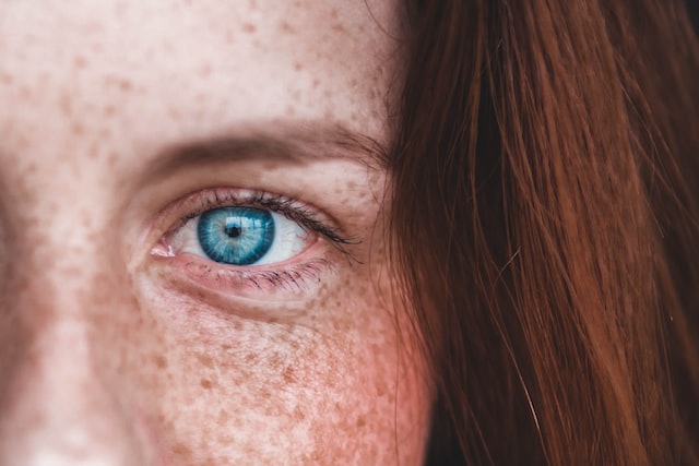Do you suffer from rosacea?